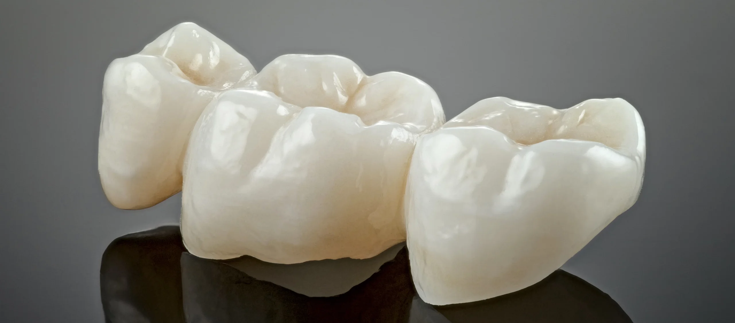 Dental bridges in Winchester at Parchment Street Dental