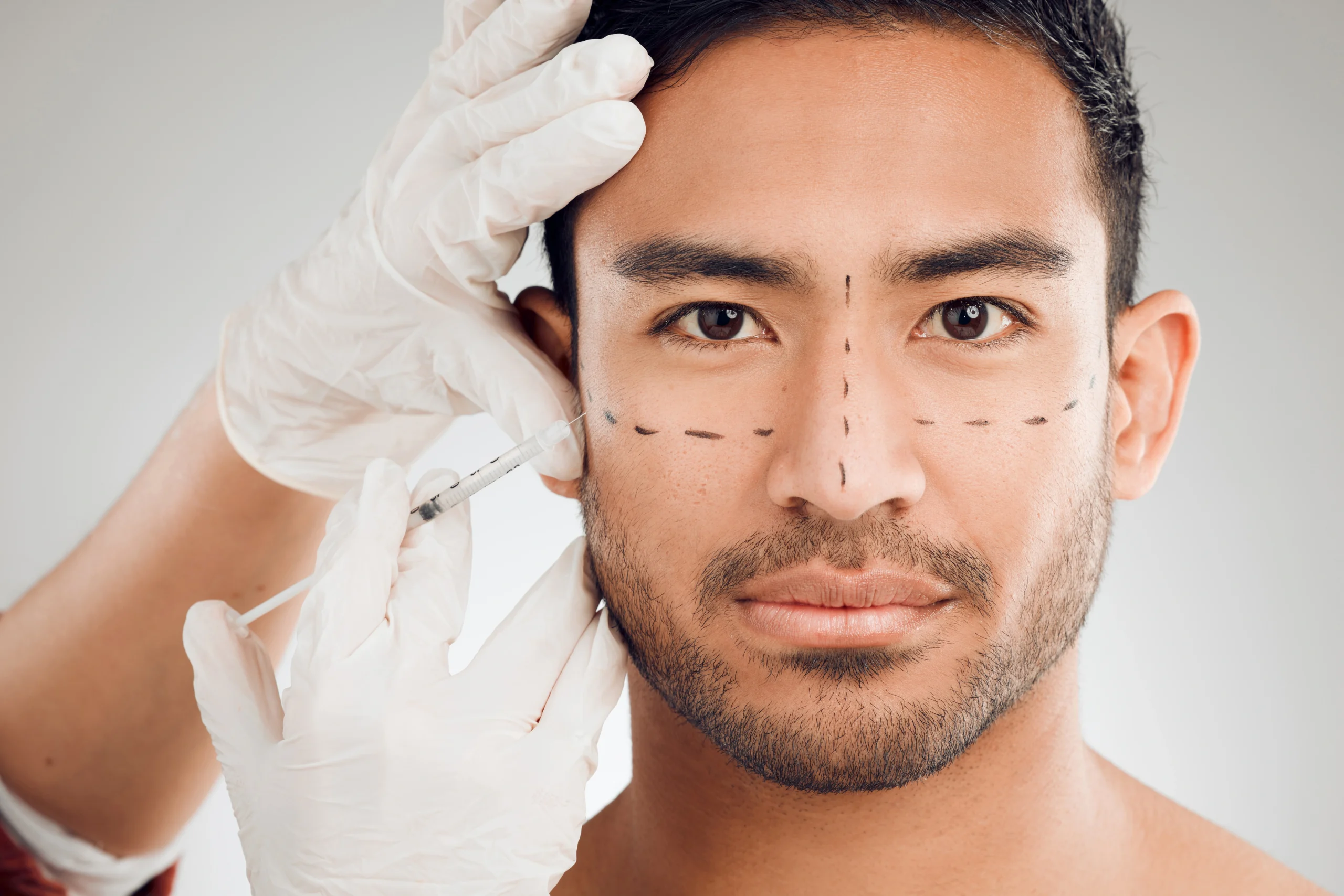Dermal filler consultation at Parchment Street Dental Winchester