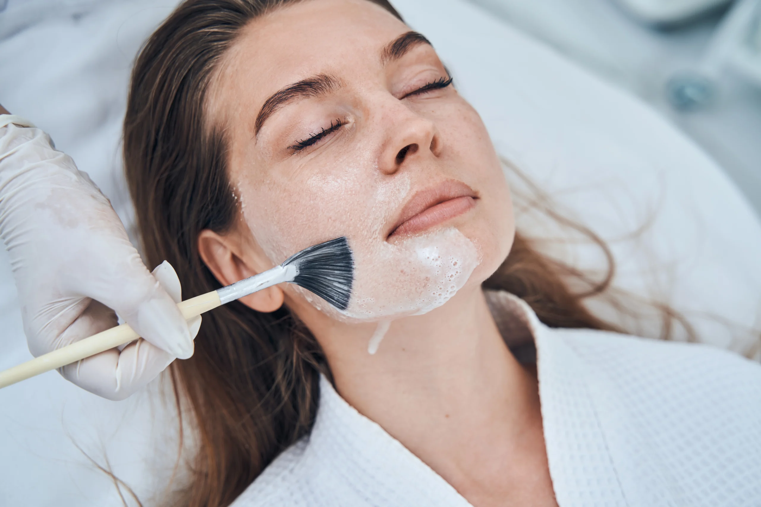 Chemical peel treatment in Winchester at Parchment Street Dental