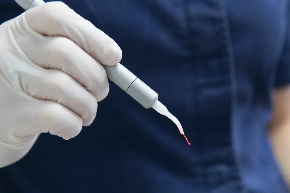 Laser dentistry at Parchment Street Dental Winchester