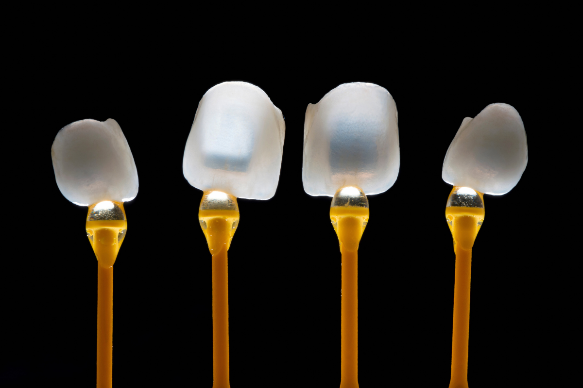 Porcelain veneers at Parchment Street Dental Winchester